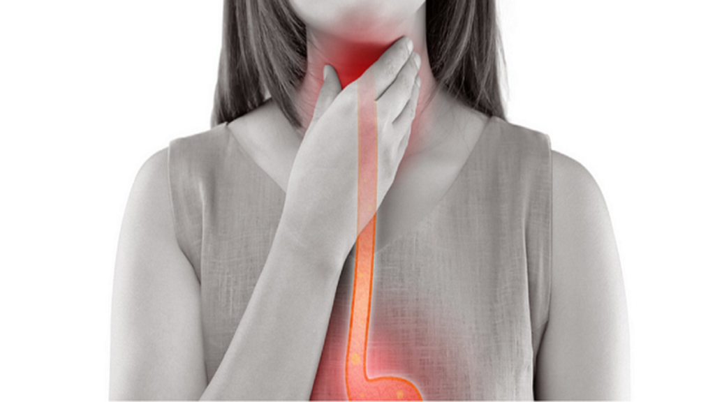 Home Remedies for Laryngitis