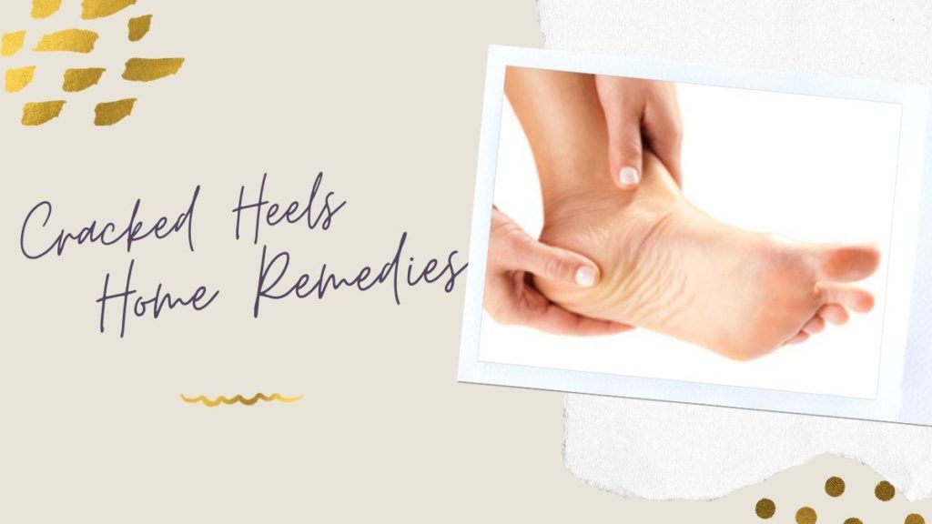 Home Remedies for Cracked Heels