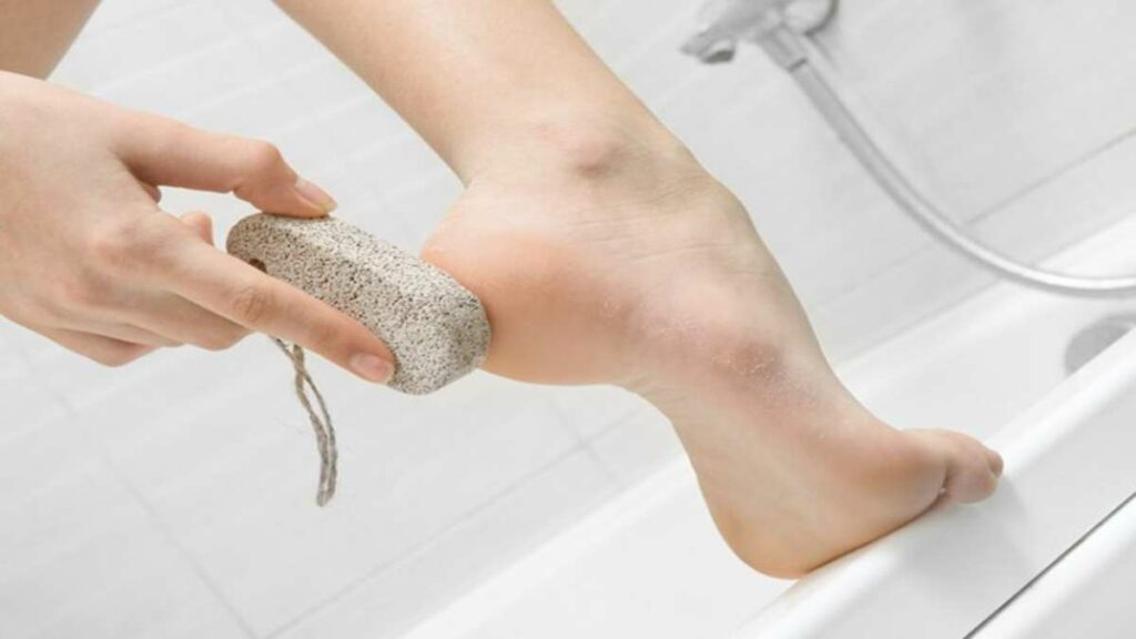 Remove Dead Skin From Feet